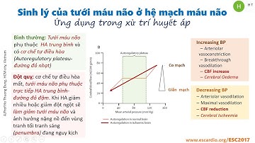 Xử trí THA ở bệnh nhân Đột quỵ não cấp  PGS TS Hồ Thượng Dũng 2021