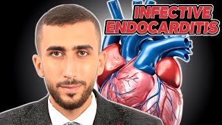 Master Infective Endocarditis & Rheumatic Fever | USMLE Step 1 High-Yield