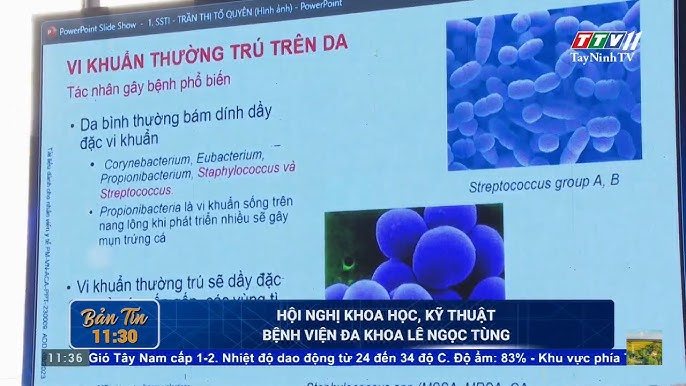 Image hình ảnh hình ảnh hình ảnh hình ảnh hình ảnh Lê Ngọc Long - Hội nghị Khoa học, kỹ thuật bệnh viện đa khoa Lê Ngọc Tùng ...