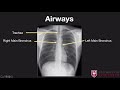 Introduction to chest xrays