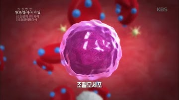 생로병사의 비밀 - 조혈모세포이식이란?.20180926