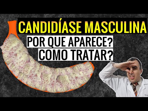 CANDIDÍASE MASCULINA: porque aparece e como tratar?