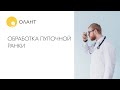 ОБРАБОТКА ПУПОЧНОЙ РАНКИ Как ухаживать за пупком. Как обрабатывать пупок