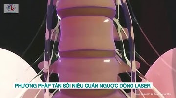 NỘI SOI NGƯỢC DÒNG TÁN SỎI NIỆU QUẢN BẰNG LASER