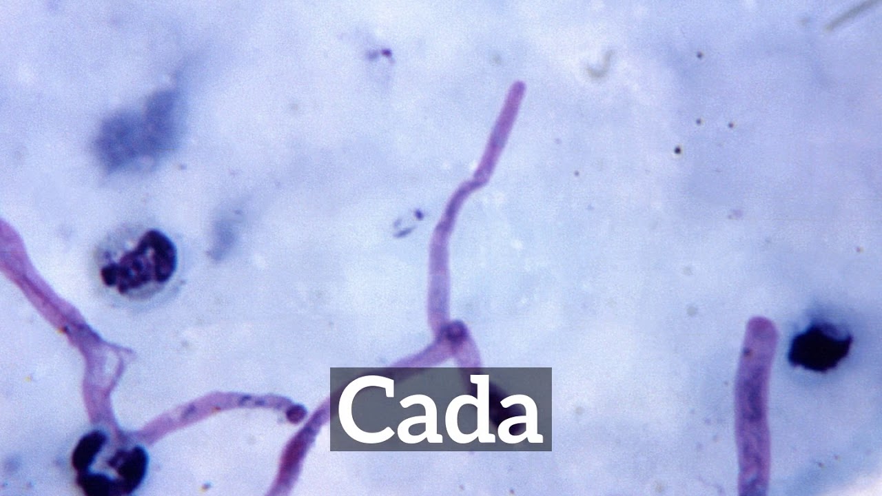 What Is Cada How To Say Cada In English How Does Cada Look YouTube What Is Cada How To Say Cada In English How Does Cada Look YouTube