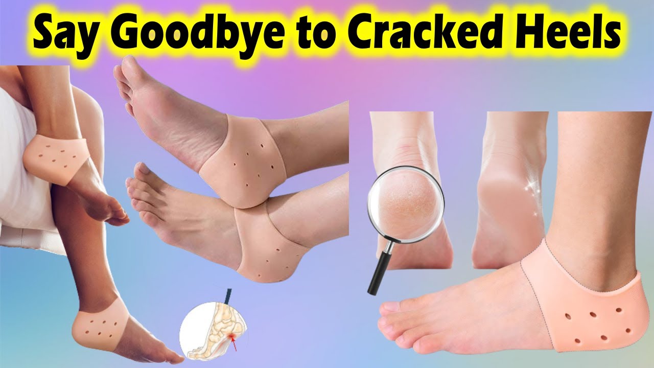 Say Goodbye to Cracked Heels with Skylike Heel Pad Socks 