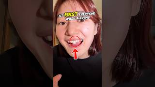 Her Bunny Teeth Got Stuck Then The Dentist Did This