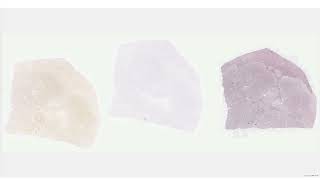 Microvisioneer mvSlide Freeze Mode - Combine differently stained sections on one virtual slide