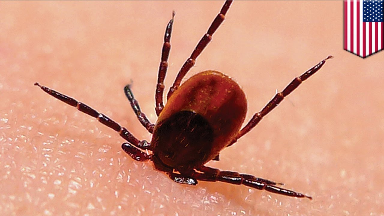 Worried About Lyme Disease? Find Out If You're At Risk