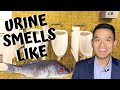 5 reasons why your urine smells like fish  explained by urologist dr robert chan md