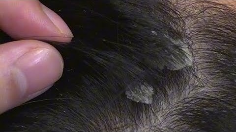 ASMR-Super comfortable scalp care