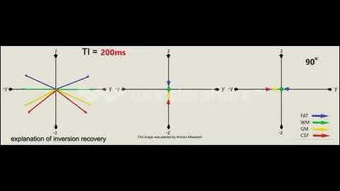 explanation of inversion recovery in MRI