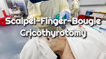 Scalpel-Finger-Bougie Cricothyrotomy Technique