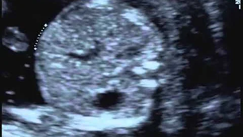 Come è la pancia a 16 settimane?