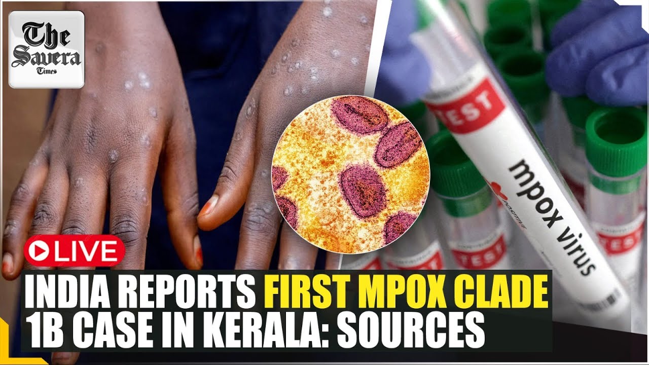 Live : India reports first Mpox clade 1b case in Kerala: Sources - YouTube