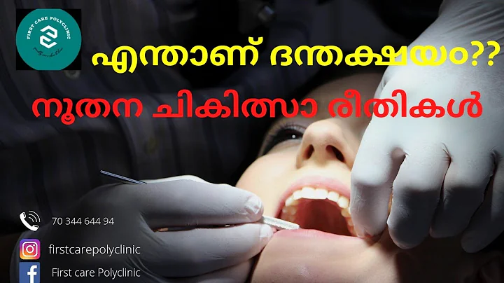 Dental Cavity | Root Canal Treatment | Dr Shafeek ...