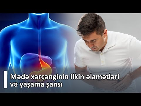 Video: Tomoqrafiya boş mədədə aparılmalıdır?