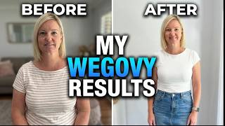 Wegovy Weight Loss Transformation. My 12 MONTH Results, Review & Side Effects