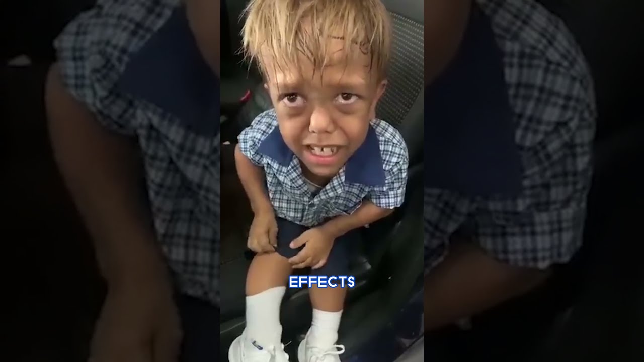 A Child Who Was Bullied For His Dwarfism Is Now Hollywood Actor