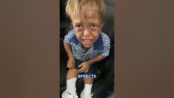 A child who was bullied for his dwarfism is now a Hollywood actor