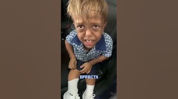 A child who was bullied for his dwarfism is now a Hollywood actor
