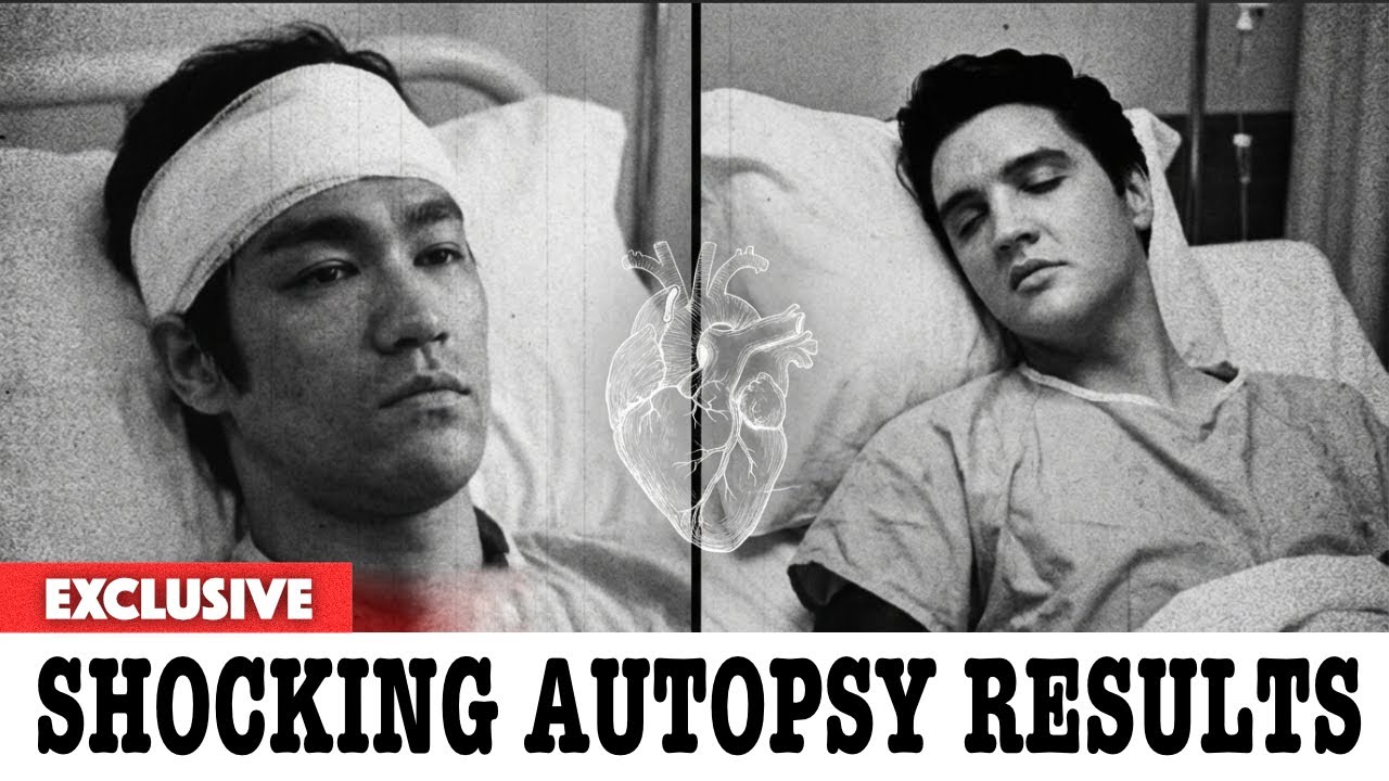 The Bizarre Medical Conditions Found After Death