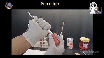 How to Prepare a Cell block In cytology by Plasma Thromboplastin Method | Practical Demonstration