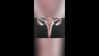 Envita - Uterine Cancer Treatment