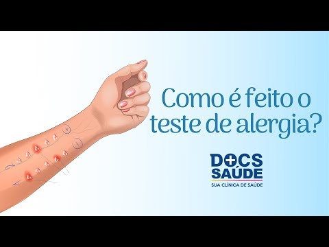Vídeo: Teste De Alergia: Objetivo, Procedimento E Resultados