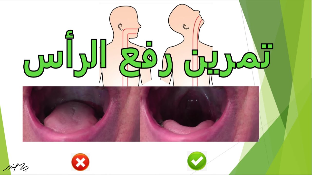 تمرين سريع للتخلص من الغنة وكتم الصوت | أ.ريمه صنوبر