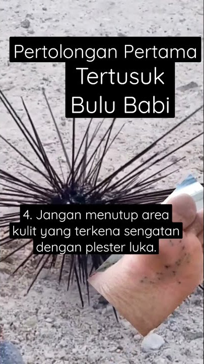 Pertolongan Pertama Tertusuk Bulu Babi | 4. Jangan menutup area terkena sengatan #viralvideo #marine