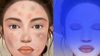 Pimple popper pro💉Makeup ASMR: Makeover story screenshot 4