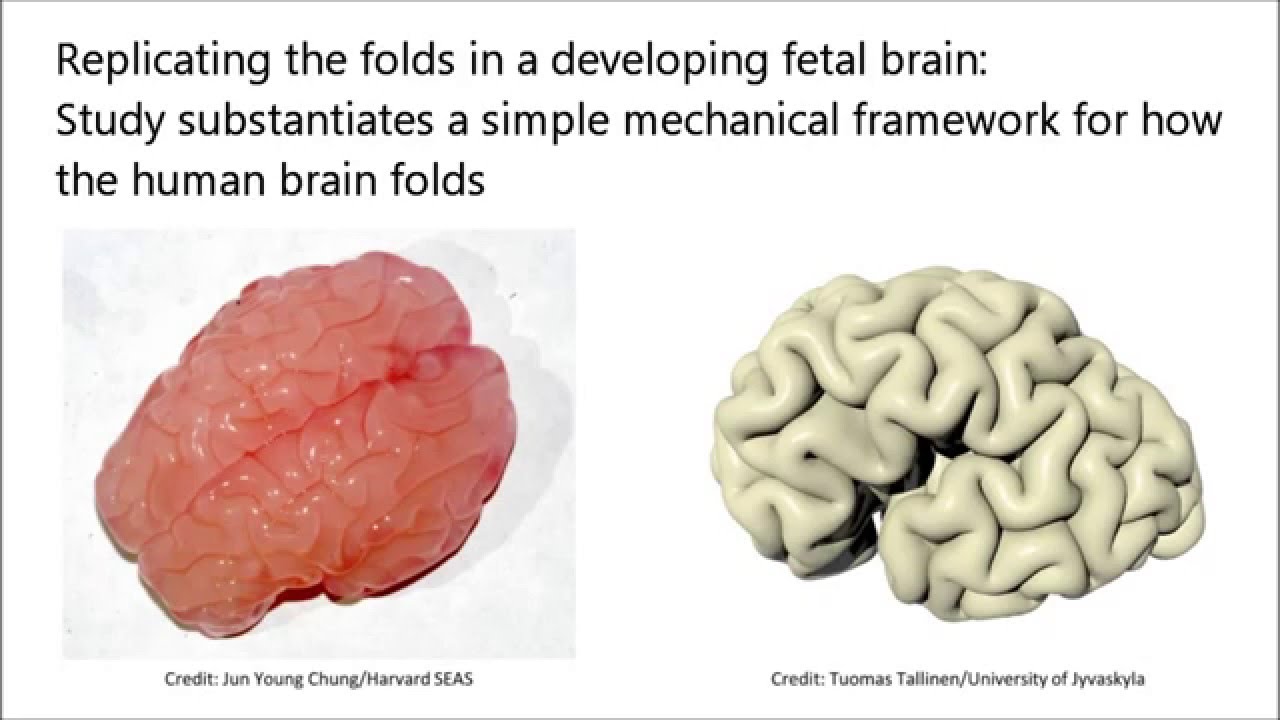 How the Human Brain Gets Its Folds