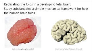 How the Human Brain Gets Its Folds