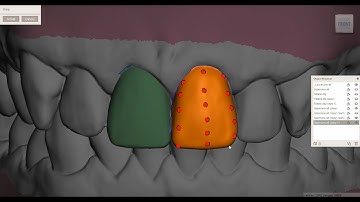 Meshmixer - Design to 3D Print