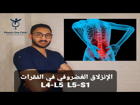 الانزلاق الغضروفي القطنى ما بين الفقرات 4 5 5 1 واهم الاسباب وطريقة التخلص من الآلام بدون جراحة
