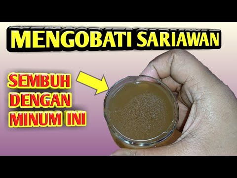  Obat  herbal  Cara mengobati sariawan  secara alami  