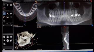 CT Markup Realtime