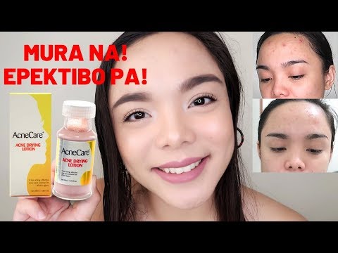 CHEAP YET EFFECTIVE ACNE DRYING LOTION | ₱ AcneCare Acne Drying Lotion