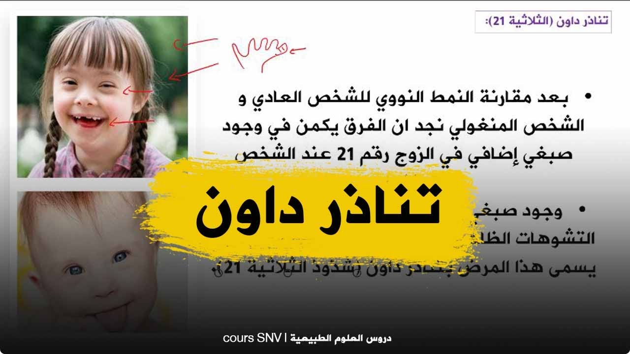 الدرس41 الاختلالات الوراثية تناذر داون علوم طبيعية للسنة الرابعة متوسط الجيسل الثاني