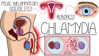 Understanding Chlamydia (Chlamydia Trachomatis Explained Clearly)