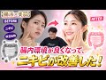 【内臓温度を上げて便秘解消】腸もみをやったらニキビ・肌荒れなくなった!内臓温度をあげると誰でも綺麗になる!