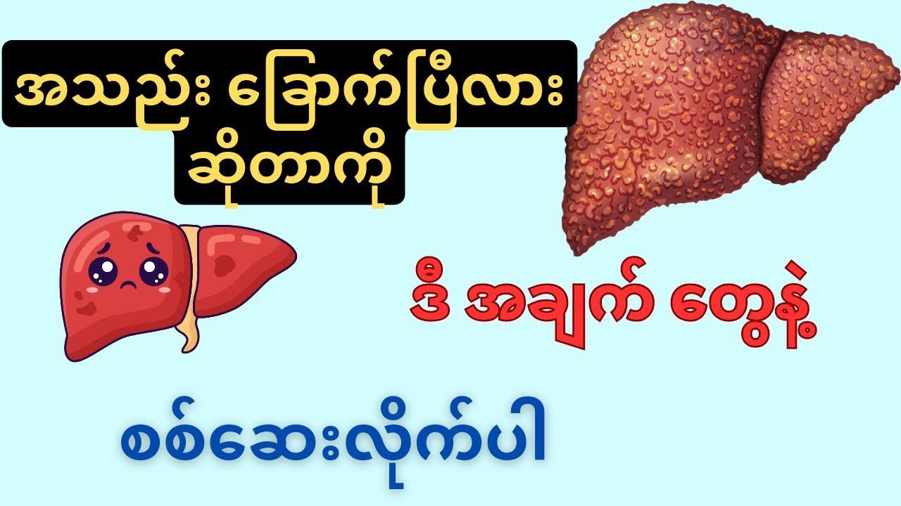 အသည်းခြောက်နေလားဆိုတာကို ဒီအချက်တွေနဲ့ စစ်ဆေးလိုက်ပါ။