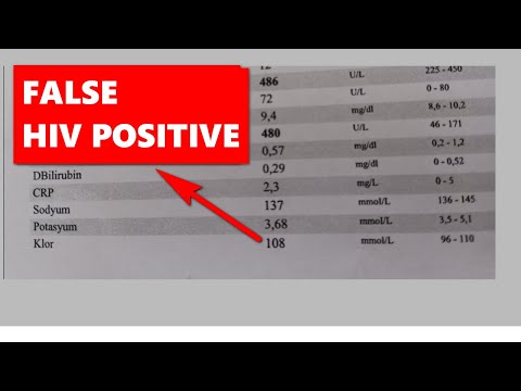 HIV TEST INTERFERENCE! ALL FALSE HIV POSITIVE REASONS!