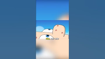 What Happened To Cody’s Eye! SML ANIMATION #shorts #sml #animation