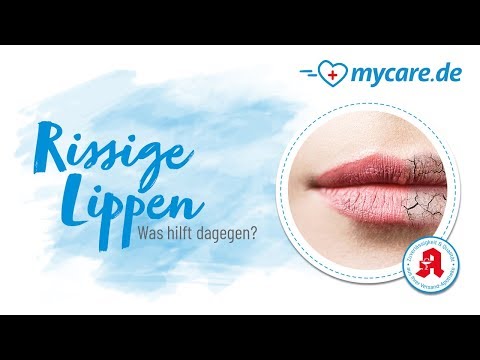 Rissige Lippen - Was hilft dagegen?