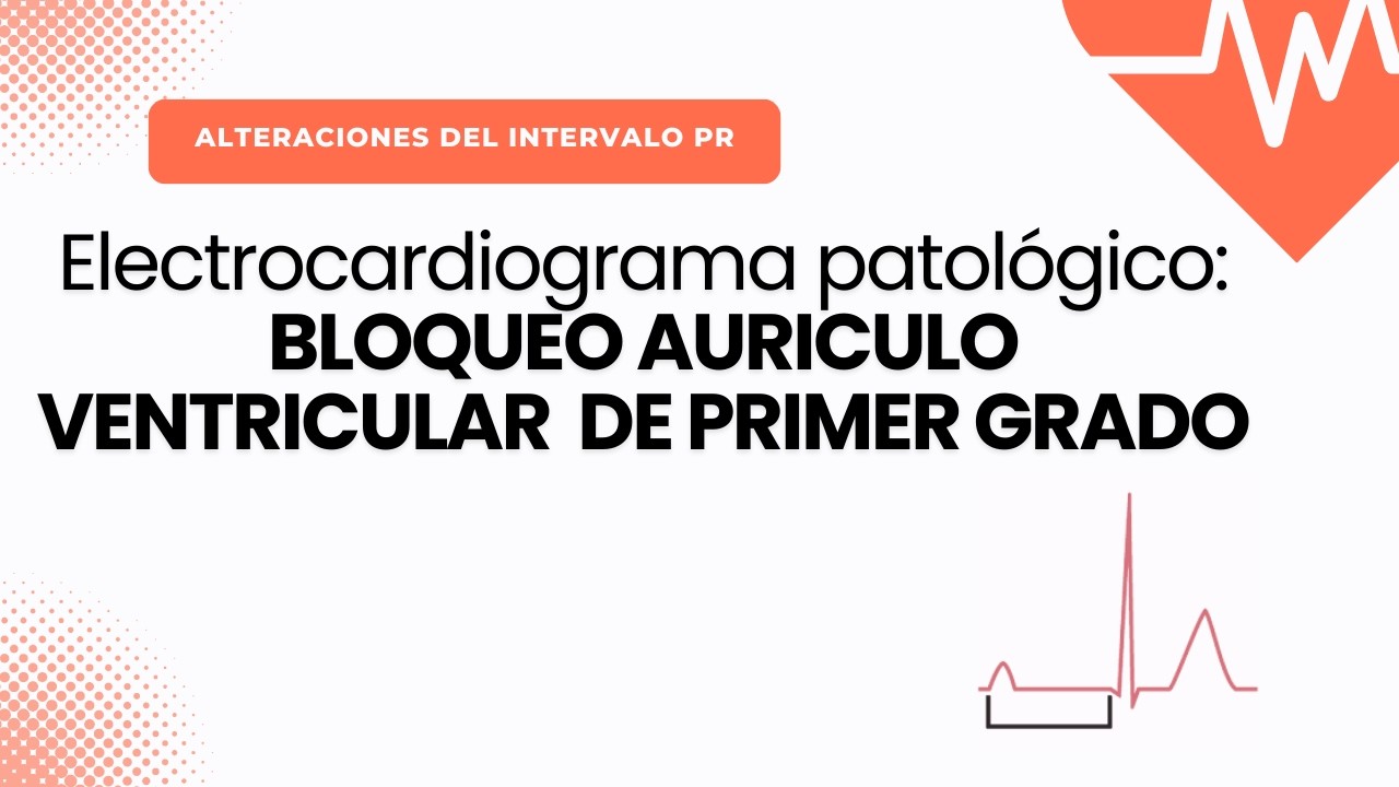 Electrocardiograma Patológico: BLOQUEO AV PRIMER GRADO