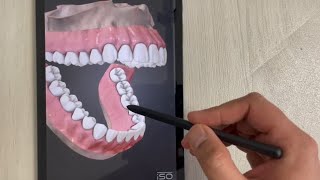 3D Dental Anatomy - Bonebox Dental Lite Tutorial - For Dental Students screenshot 2