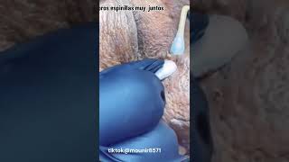 TiKToK PIMPLES POP