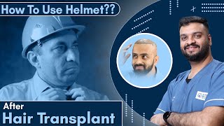 Job or Bike Helmet AFTER Hair Transplant | When To Wear Helmet AFTER Hair Transplant? | Preacutions.